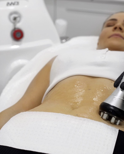 Contouring Bodies Sydney CG22